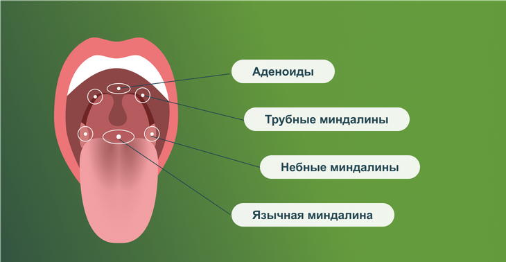 Анатомия горла: расположение миндалин 