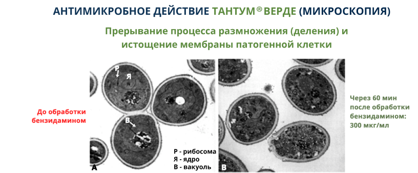 Тантум верде при кандидозе