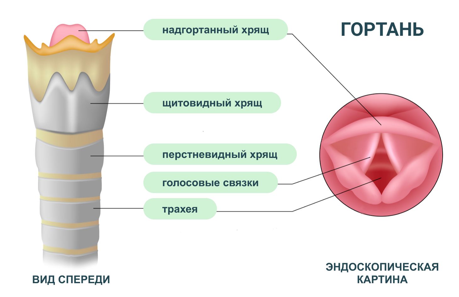 Ларингит: всё о методах лечения и препаратах.
